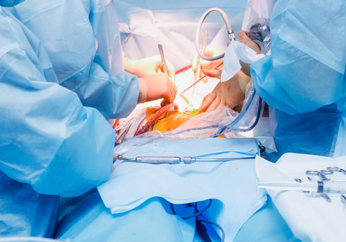 Robotic and Laparoscopic Surgery