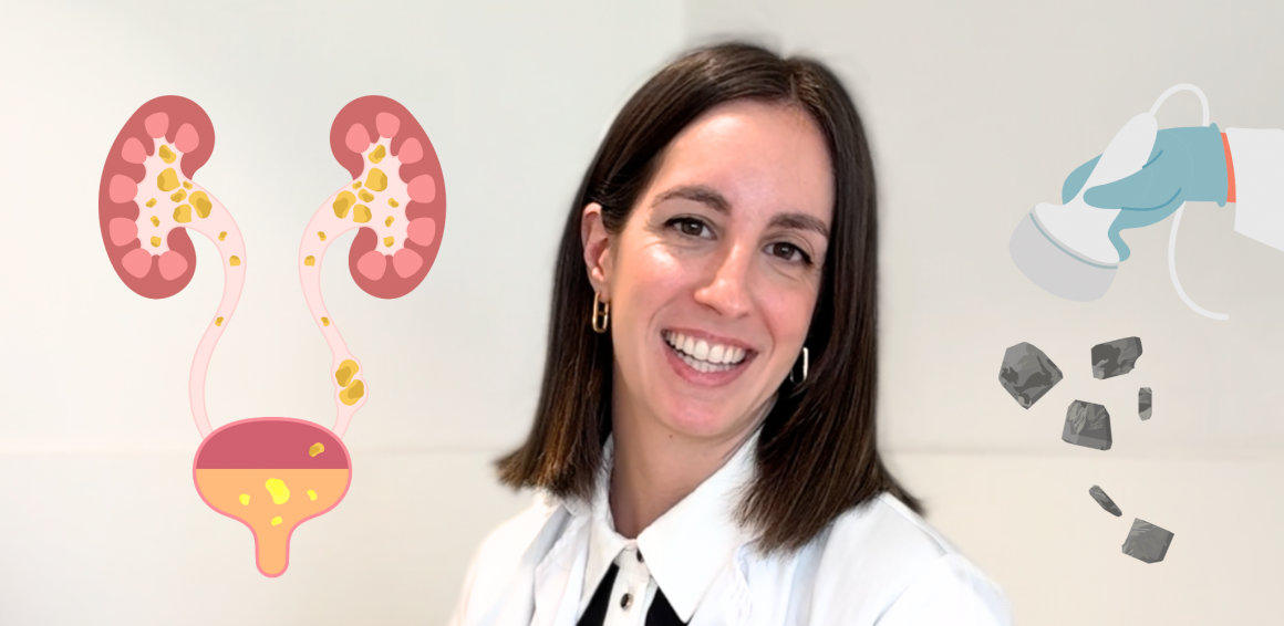 Dra. Sanz con imagen de piedras en las vías urinarias
