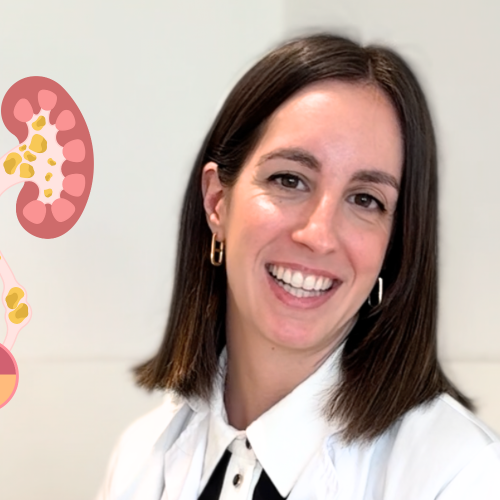 Dra. Sanz con imagen de piedras en las vías urinarias